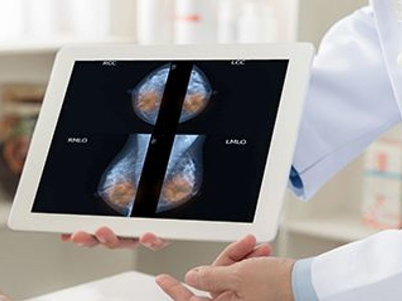 Breast Arterial Calcification on Mammography Tied to CVD Risk