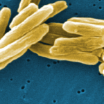 Non-severe tuberculosis in children can be treated with a shorter 4-month regimen