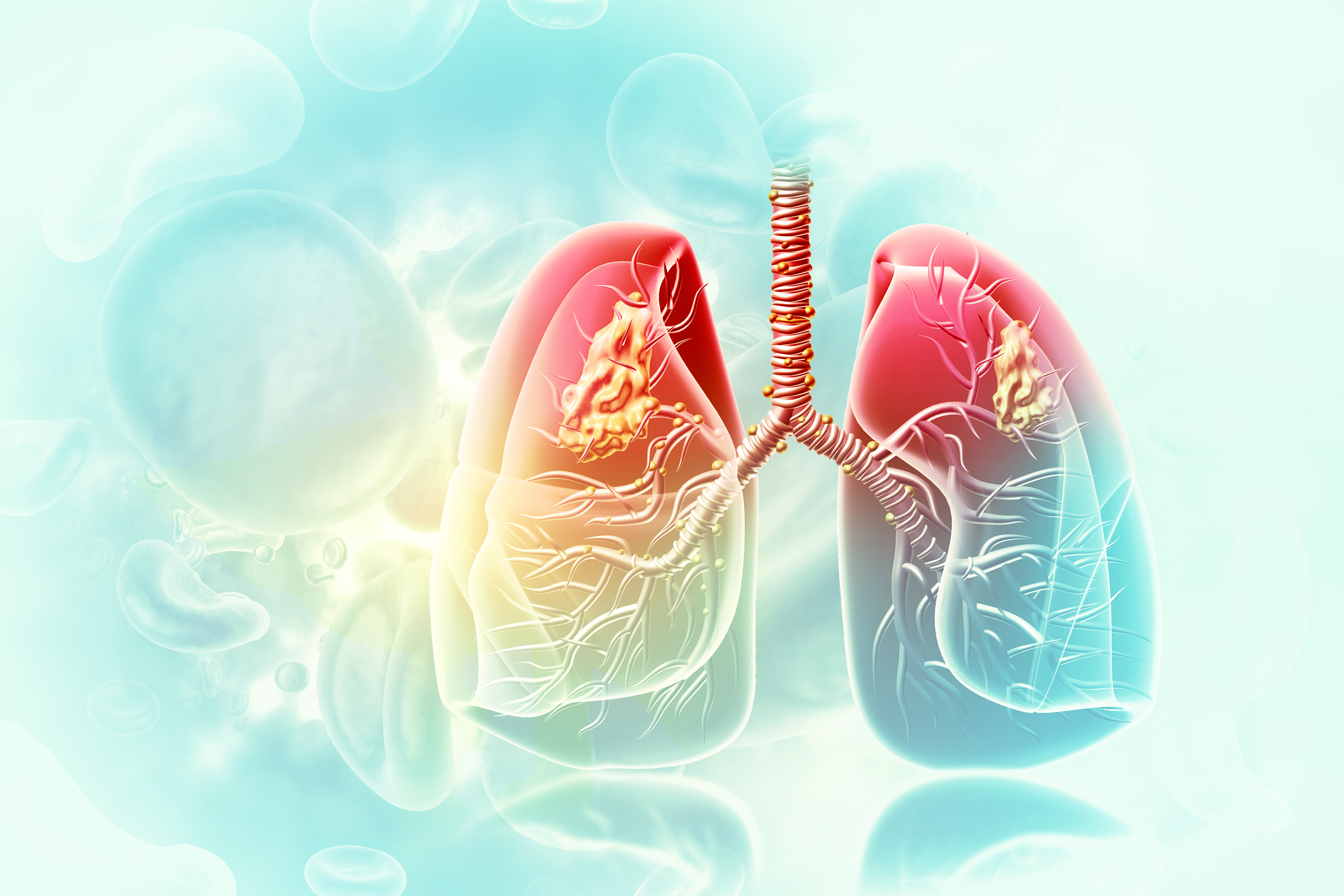 Symptoms and Warning Signs of Lung Cancer as Perceived by Primary Healthcare Providers