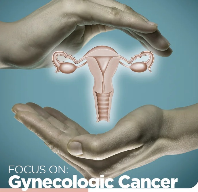 Gynecological Cancer eBook