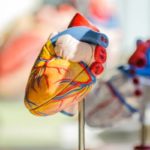 High physical activity may have a role in increasing coronary artery calcification