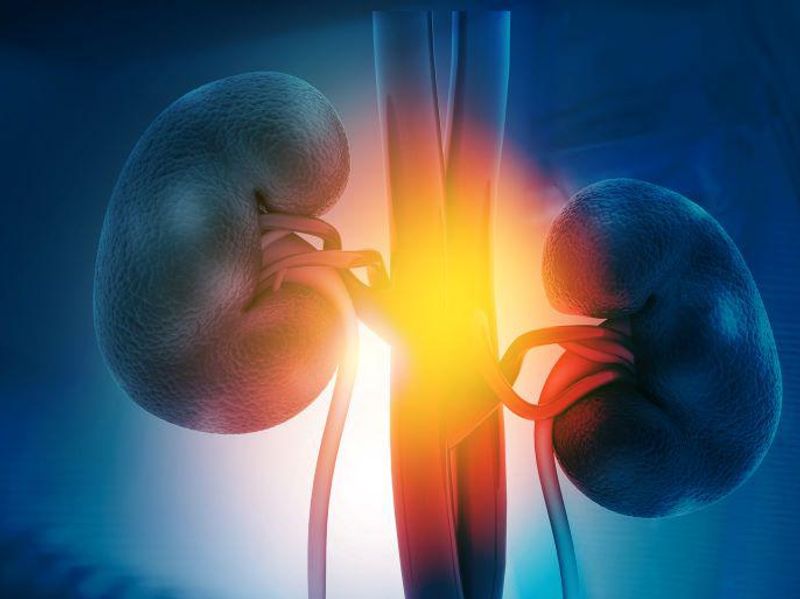 Rate of Major Complications Low With Living Donor Nephrectomy