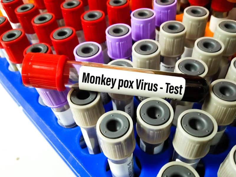 Monkeypox Poses Challenges, Even in High-Income Countries