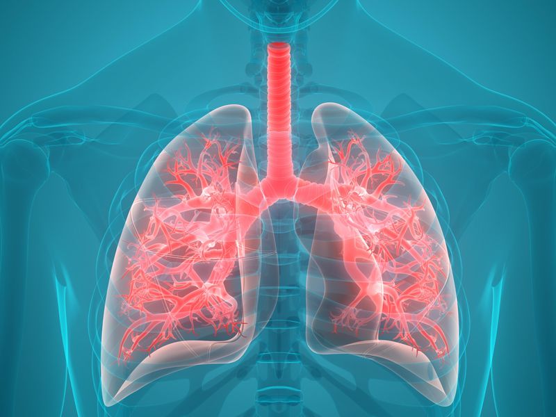 Lung Abnormalities ID’d on Hp-XeMRI in Nonhospitalized Long COVID Patients