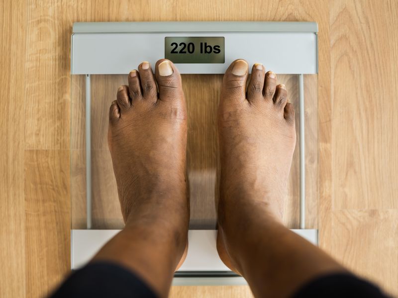Bariatric Surgery Cuts Obesity-Related Cancer Incidence