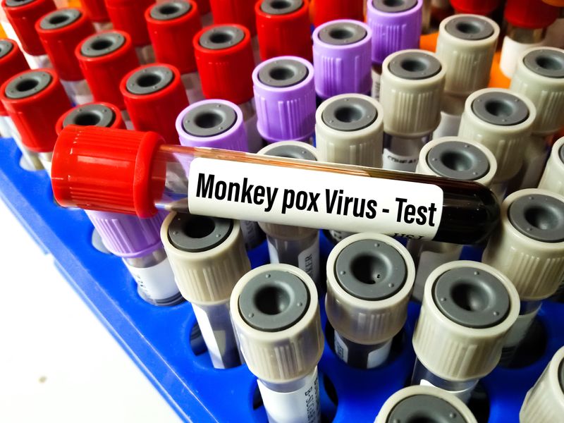 WHO Says Monkeypox Not a Global Health Threat for Now