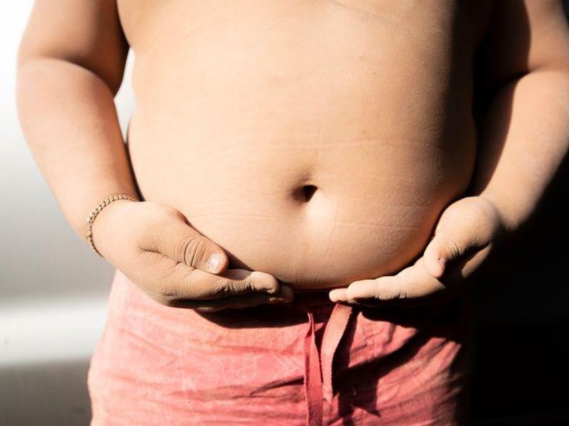 Childhood Obesity Rate in the U.S. Higher Now Than 12 Years Prior