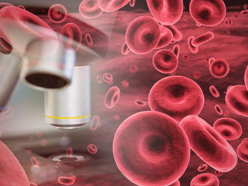 Increased Blood Viscosity Linked to Mortality in COVID-19