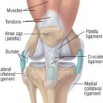 Lower body mass index and higher physical function prior to total knee arthroplasty associated with improved function postoperatively