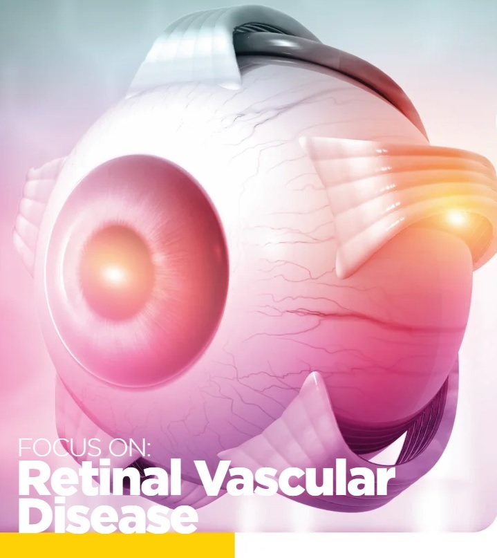 Retinal Vascular Disease eBook