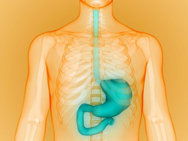 Laparoscopic Surgery Noninferior for Gastric Cancer at Five Years