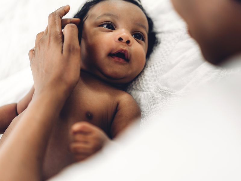Racial, Ethnic-Minority Infants Older at First Cystic Fibrosis Evaluation