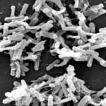 Incidence of C. difficile infections decreasing in hospitalized children