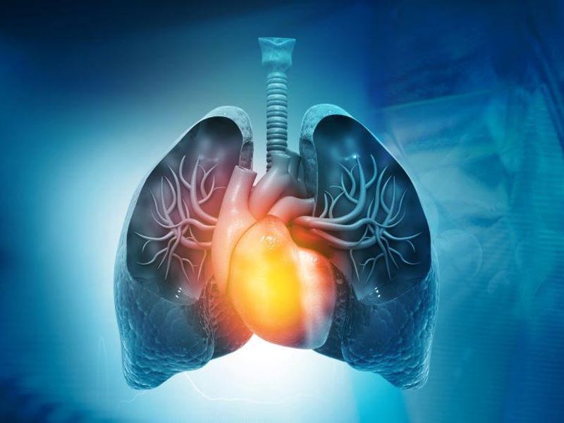 cfDNA Increased in Patients With Pulmonary Arterial
Hypertension