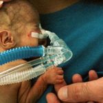 Study details use of inhaled nitric oxide in extremely premature infants in Japan