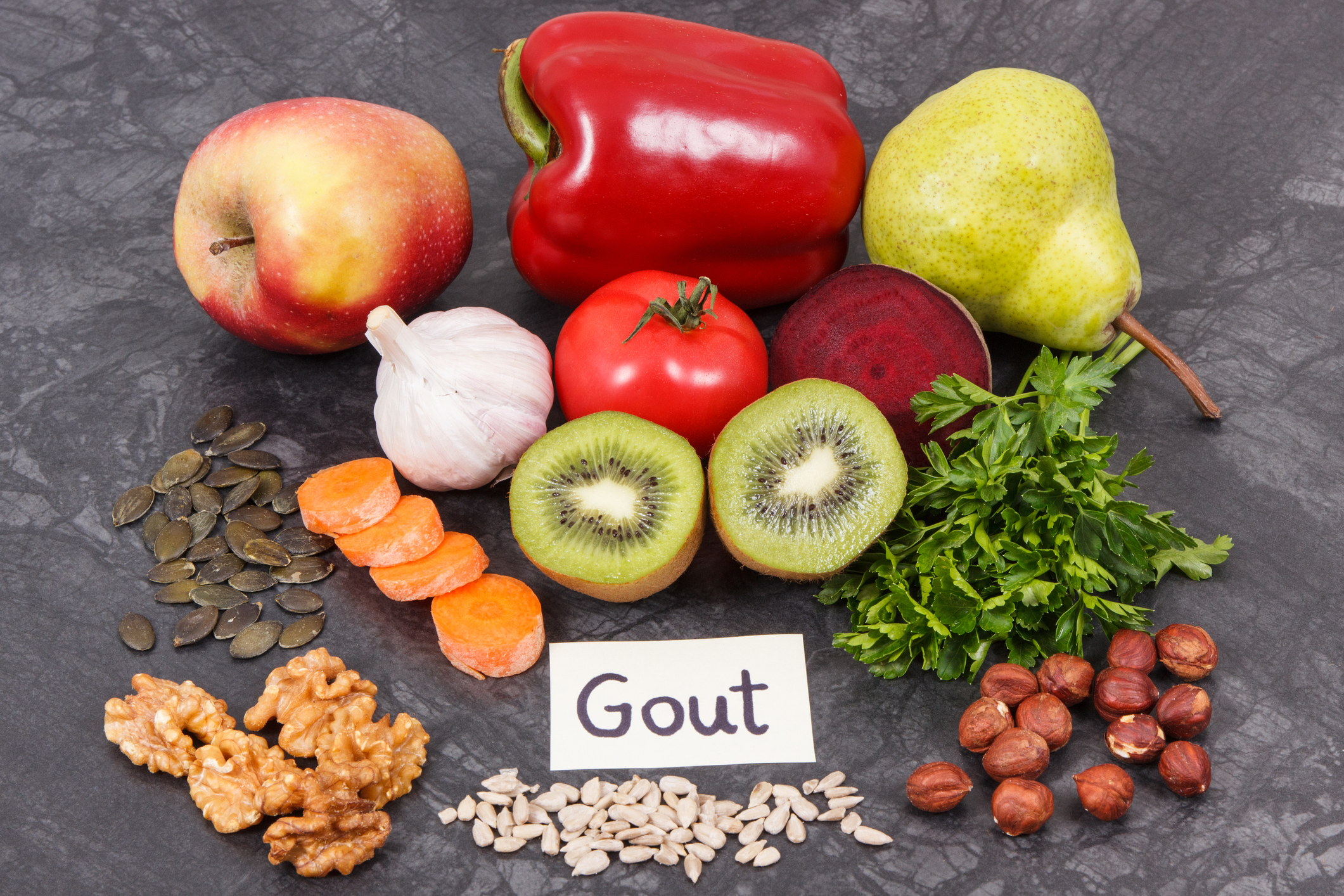 Aggressive Serum Urate Lowering Meets Goals in Gout
