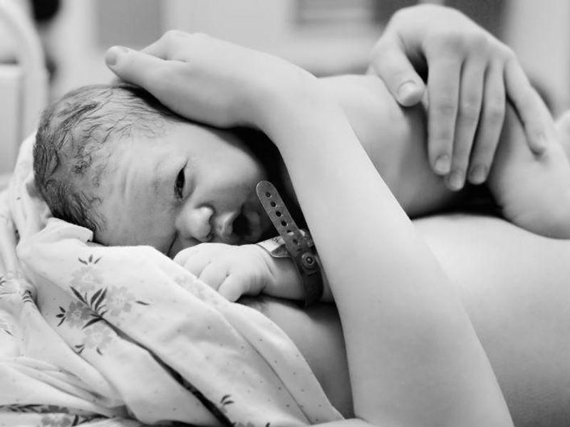 Skin-to-Skin Contact Right After Cesarean Has Benefits for Mom, Baby
