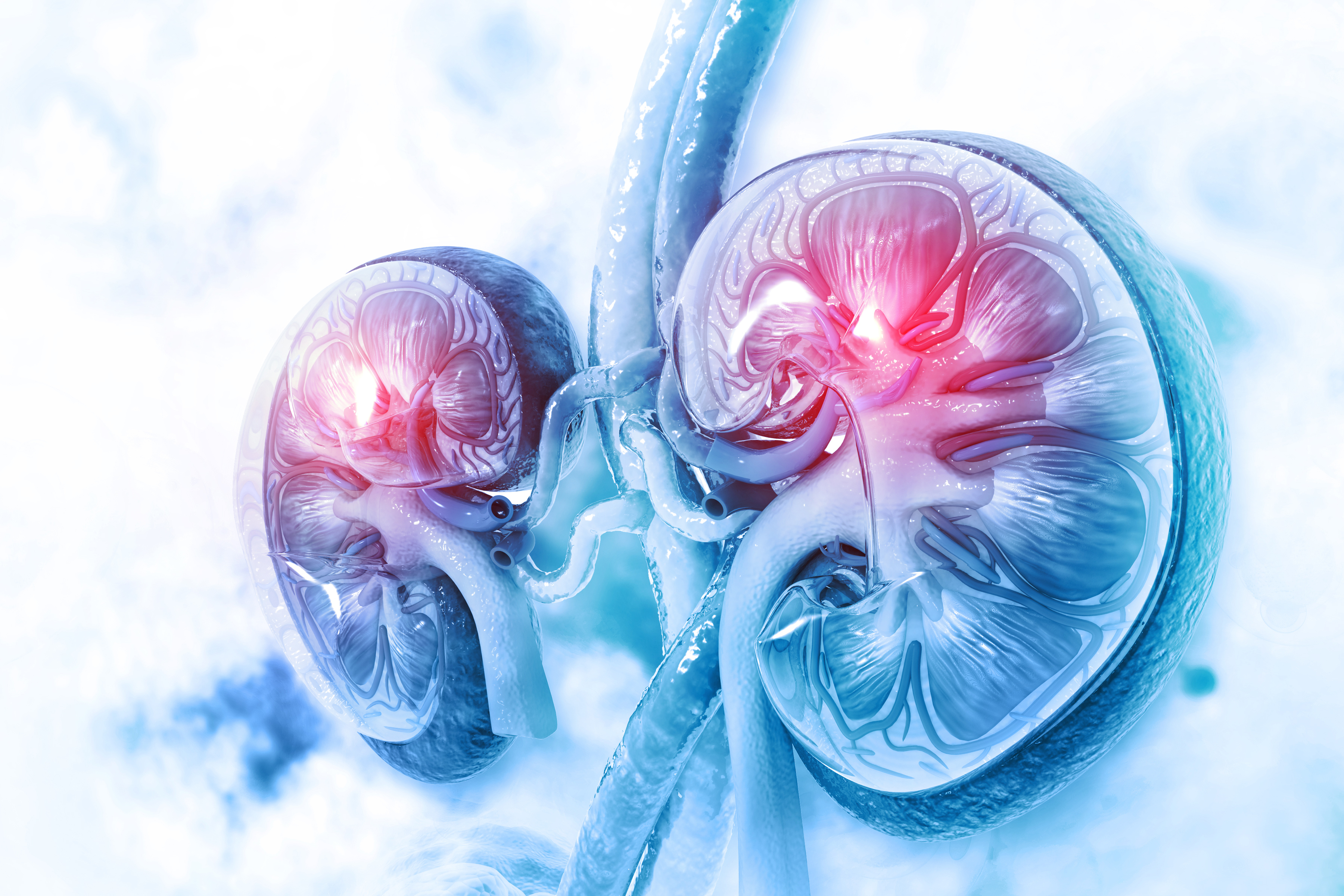 Analyzing HLA T-Cell Epitope Targets and TCMR Following Kidney Transplant