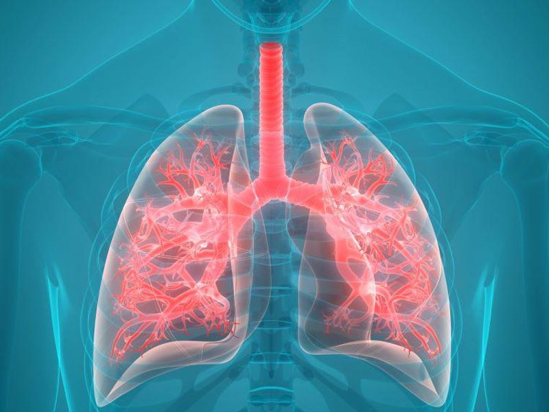 Study Looks at Extent of Residual Lung Abnormalities After COVID-19 Hospitalization
