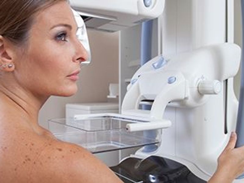 RSNA: Deductible Payments May Discourage Breast Imaging