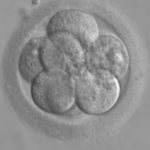 Double embryo transfer may be associated with neonatal risks