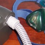 Sulthiame may be a safe and effective medication for severe obstructive sleep apnea