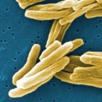 Oral BPaLM regimen is noninferior to standard of care for rifampin-resistant tuberculosis