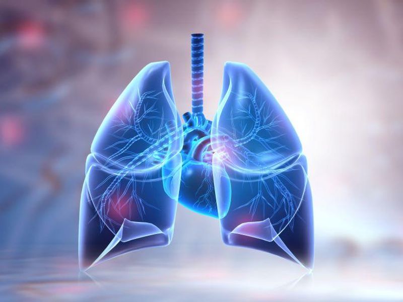 Lung Composite Allocation Score System Cuts Waiting-List Mortality