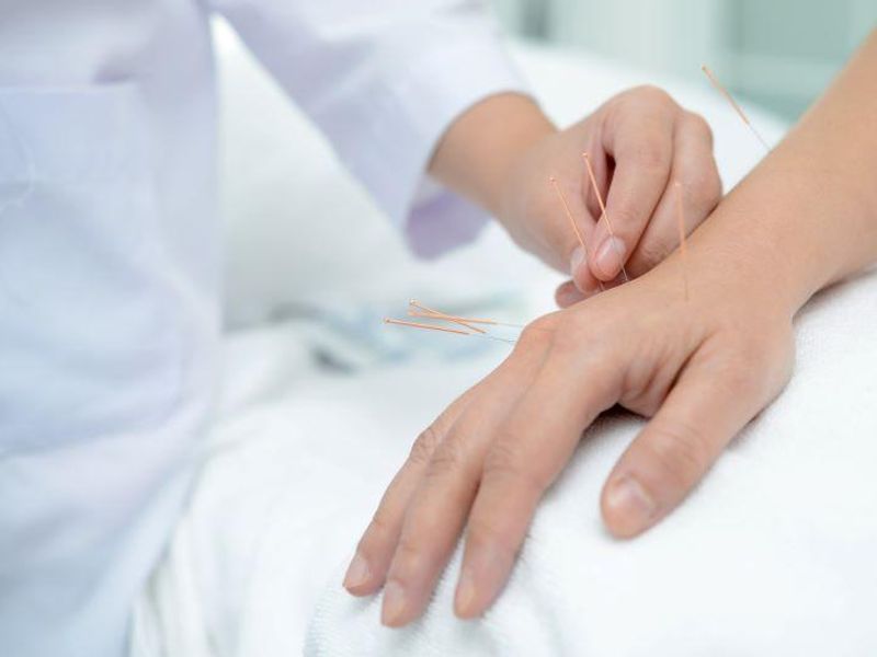 Acupuncture, Acupressure Beneficial in Gynecologic Cancer Surgery Setting