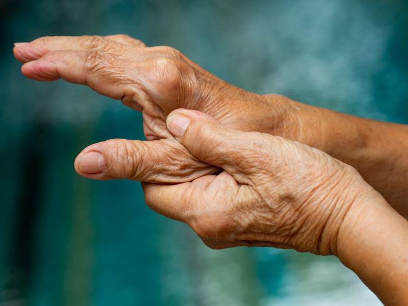 First-Degree Relatives Have High Perceived Risk for Rheumatoid Arthritis