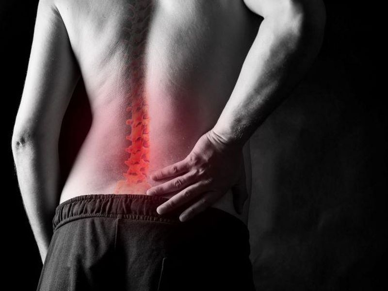 Mortality Down With Surgery for Stenosis With, Without Spondylolisthesis