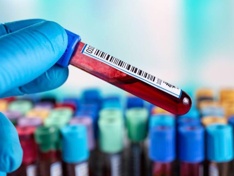 CDC Updates Recommendations for Hepatitis B Virus Screening