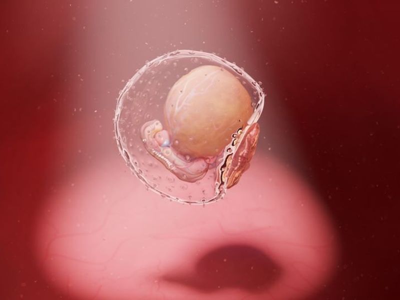 Embryonic Development Delayed in Pregnancies Ending in Miscarriage
