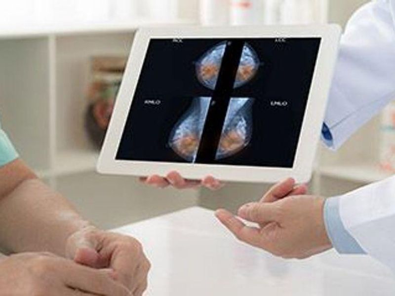 Screening Outcomes Better for Women Undergoing Digital Breast Tomosynthesis