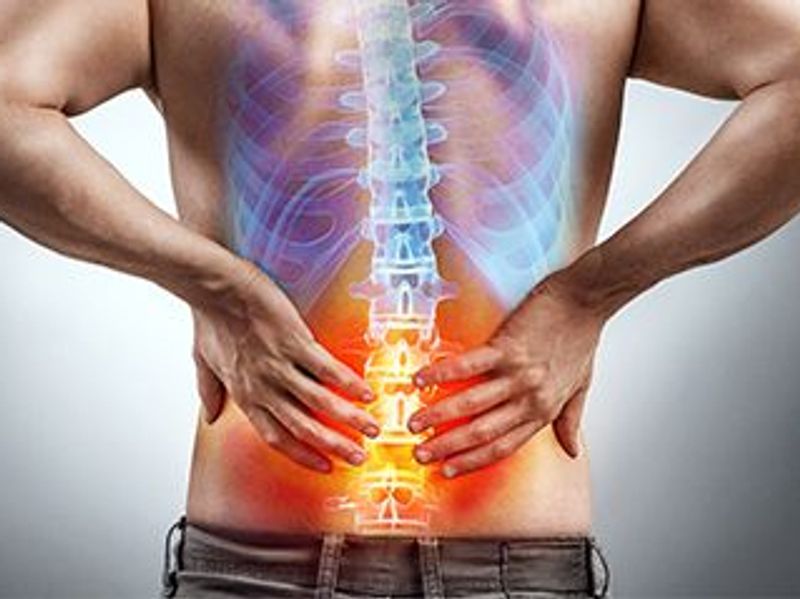 Pulsed Radiofrequency + Steroids Best for Sciatica From Herniated Disc