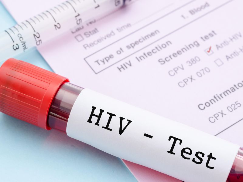 HIV Infection Tied to Higher Risk for Depression