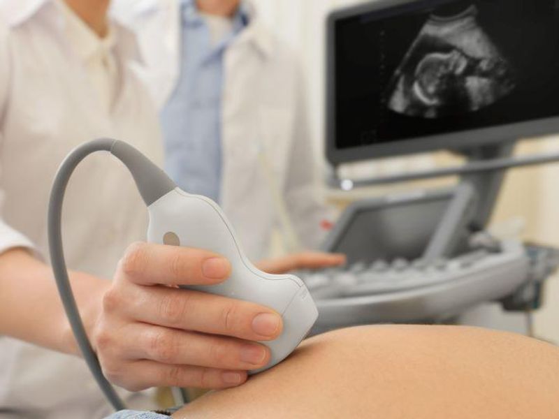 Timely Ultrasound Can ID Undiagnosed Breech Presentations
