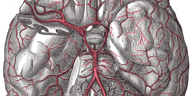 Endovascular thrombectomy for large ischemic strokes results in improved functional outcomes