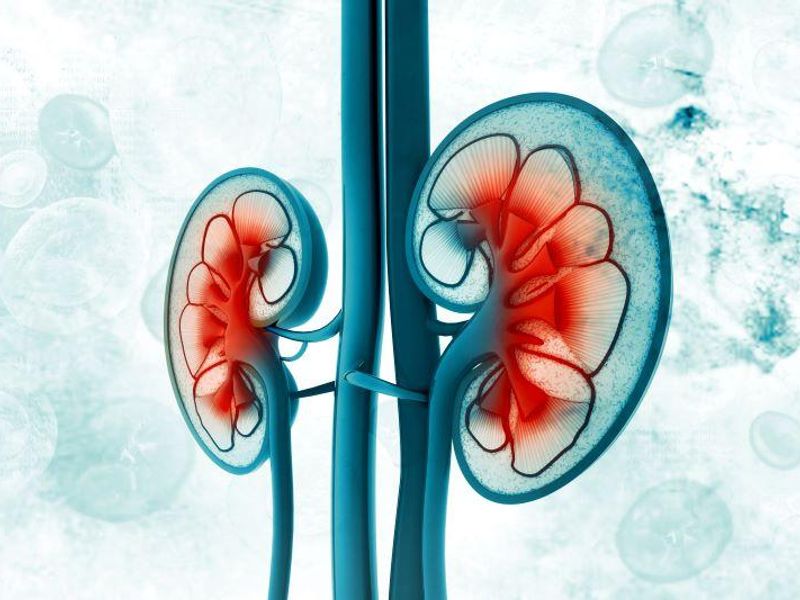 Banff Automation System Improves Diagnosis of Kidney Allograft Rejection