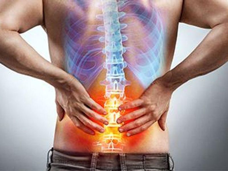 619 Million Affected by Low Back Pain Globally in 2020