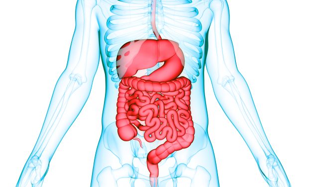 Updated Guidelines Issued for Management of Diverticulitis