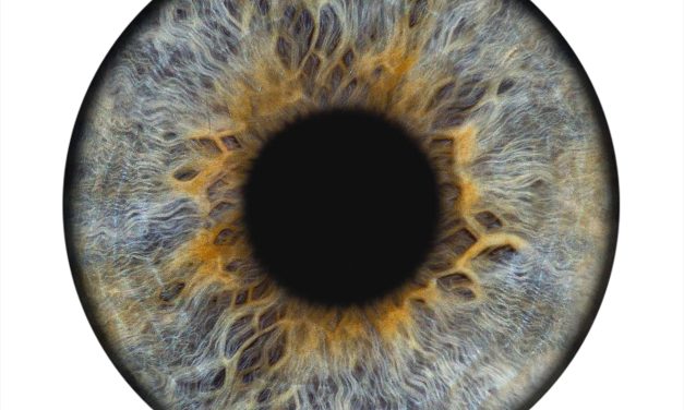 A novel c.980C>G variant in  results in identifiable gyrate atrophy phenotype associated with retinal detachment in a young female.