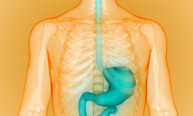 One-Fourth of Esophageal Cancers Among Those With BE Missed in Year Before Diagnosis