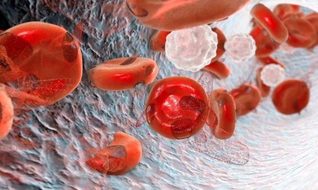 Anemia Remains Considerable Global Health Challenge