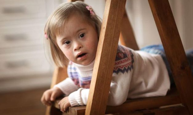 Children With Down Syndrome Experience More Medical Imaging
