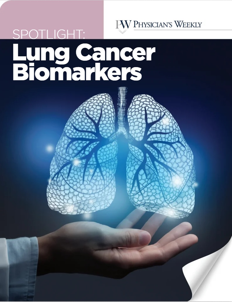 Lung Cancer Biomarkers eBook
