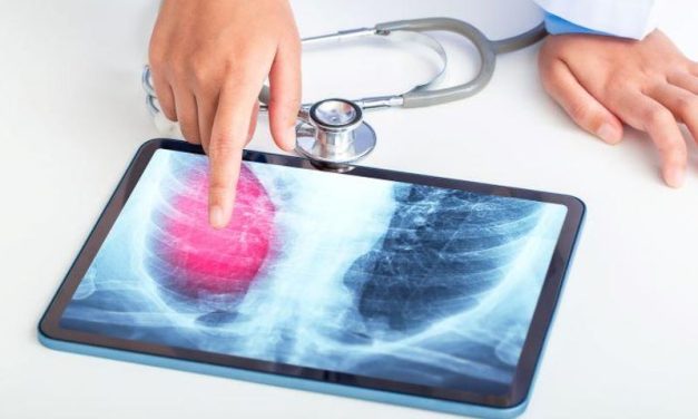 AI Tool Similar to Radiologists for Interpreting Chest Radiographs