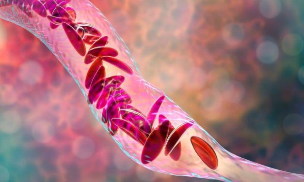 FDA Advisers to Weigh New Gene Therapies for Sickle Cell Anemia