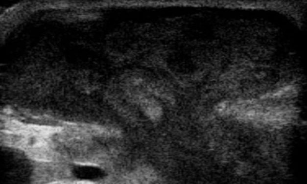 Deep learning models of ultrasonography effective in identifying superficial soft-tissue masses