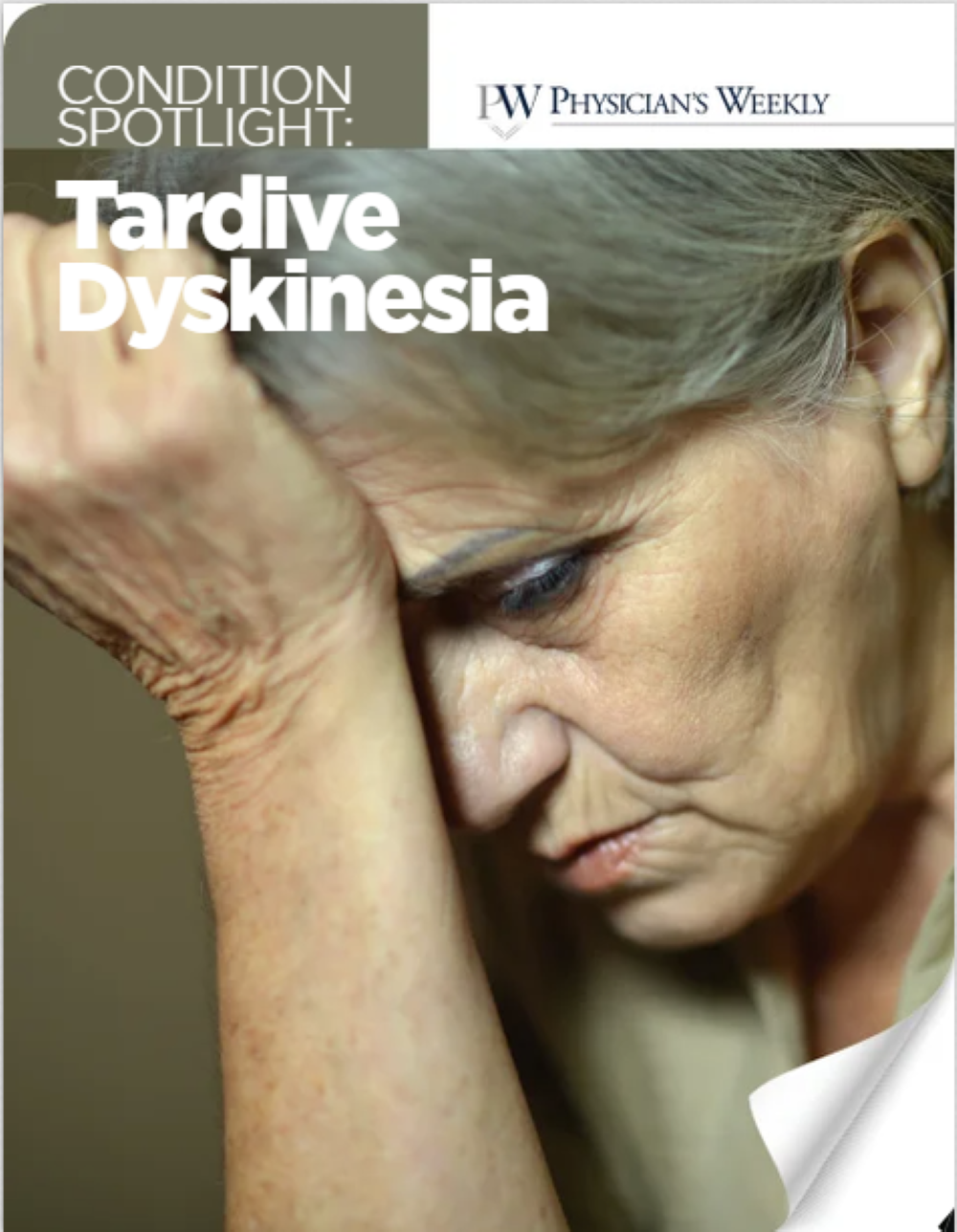 Curated, Cutting-Edge Tardive Dyskinesia Spotlight eBook